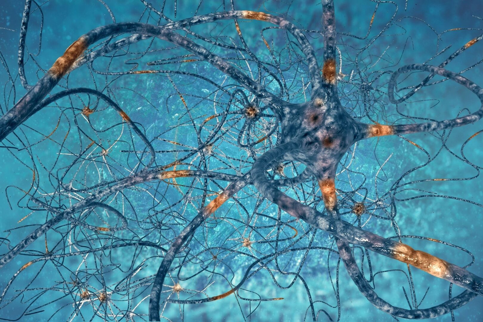 a neuron illustrating neurological conditions