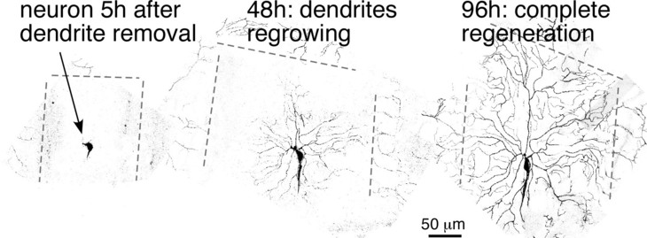 Rolls_DendriteRegeneration_1-2014